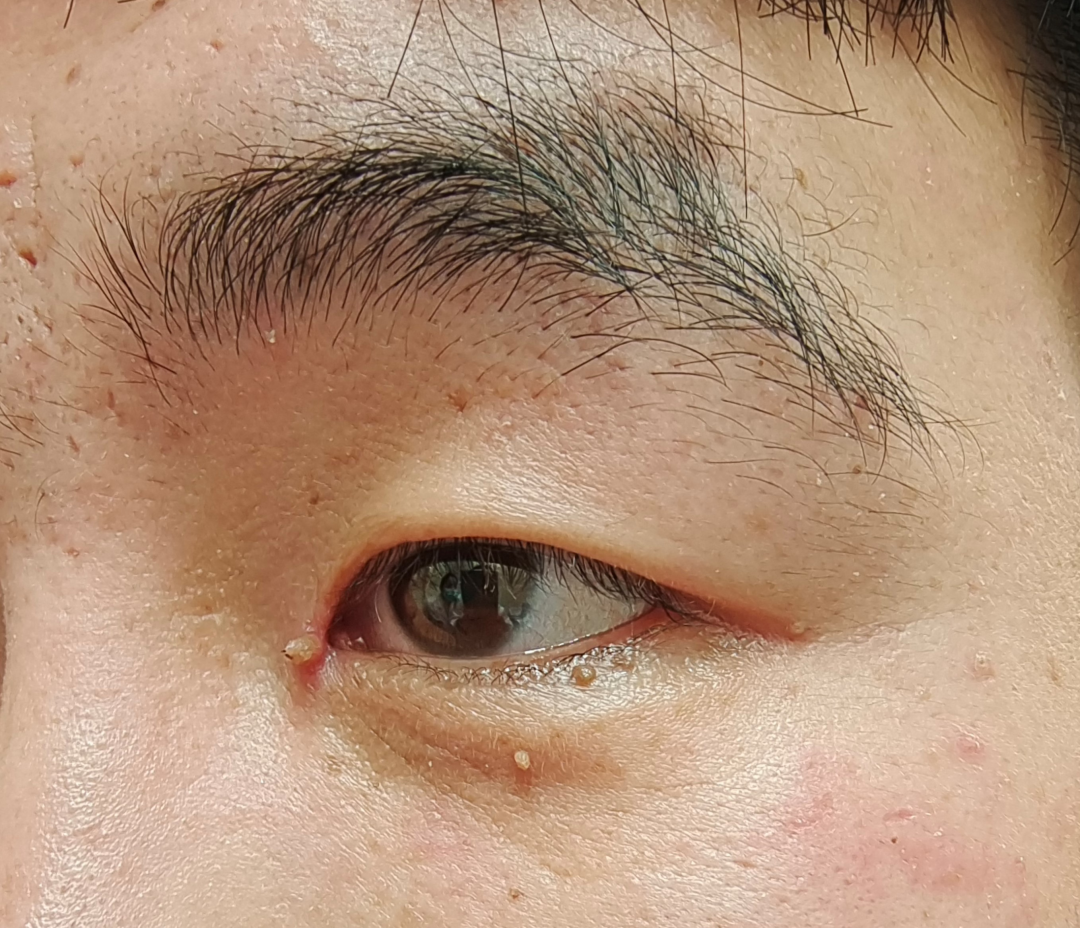 67脖子上的小肉瘤其实是它丝状疣